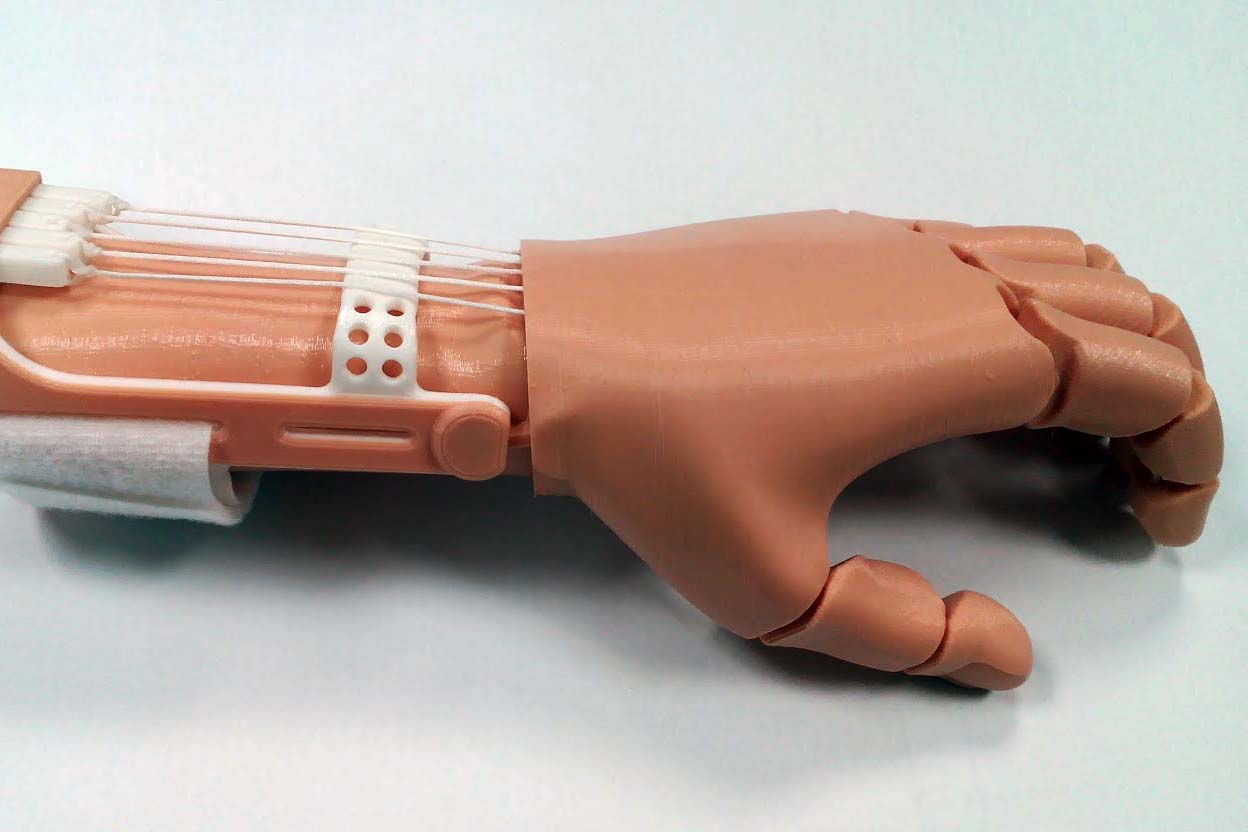 Prosthetic hand