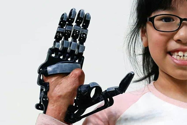 Prosthetic hand