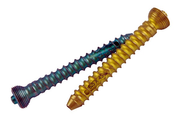 Bone screws